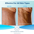Glaxal Base Moisturizing Cream 100g