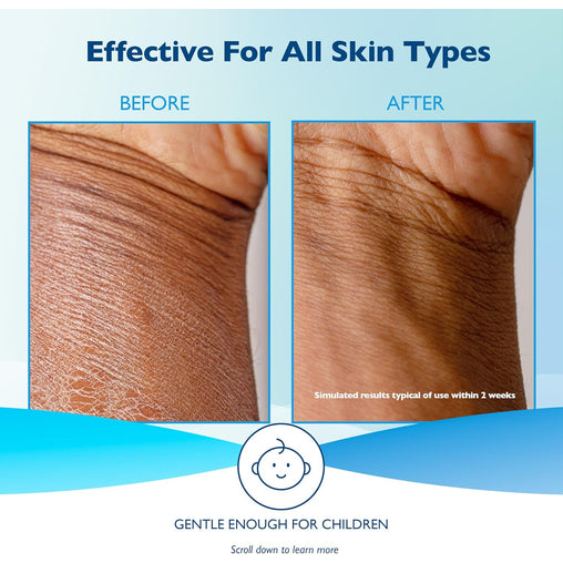 Glaxal Base Moisturizing Cream 100g